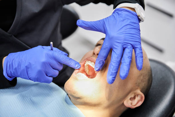 Best Emergency Dentist for Knocked-Out Tooth in Smithsburg, MD